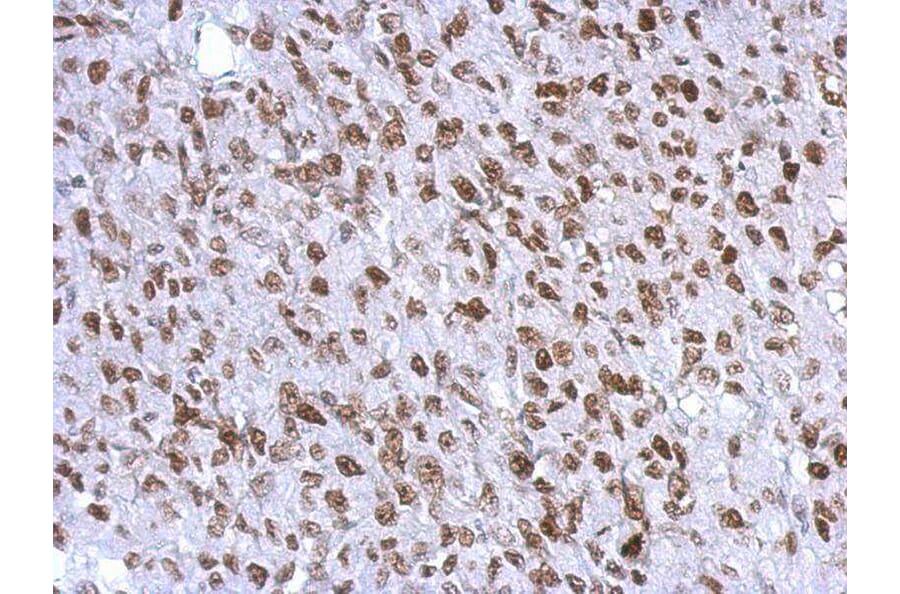 Immunohistochemistry - WT1 antibody from Signalway Antibody (22694) - Antibodies.com