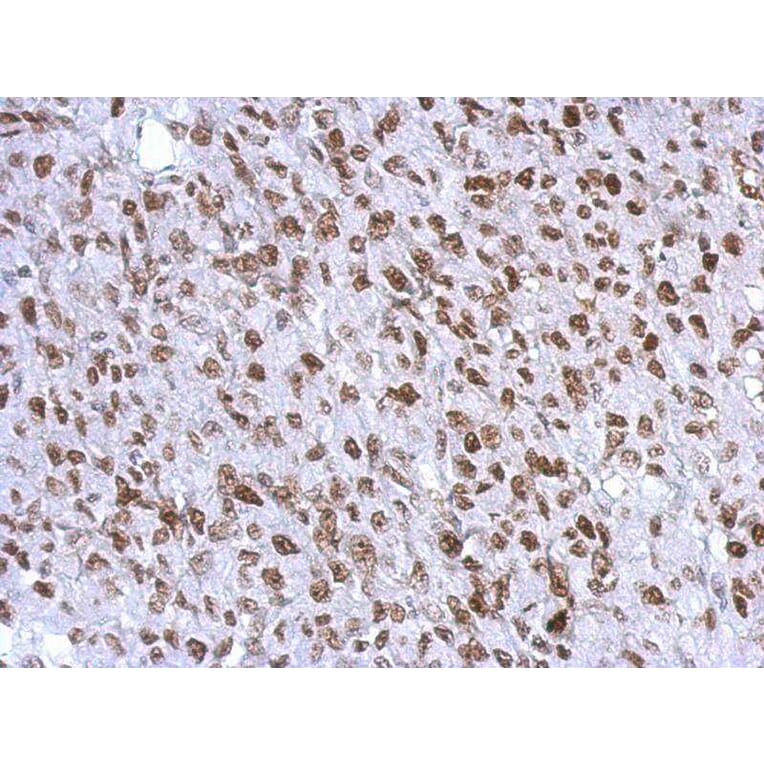 Immunohistochemistry - WT1 antibody from Signalway Antibody (22694) - Antibodies.com
