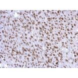 Immunohistochemistry - WT1 antibody from Signalway Antibody (22694) - Antibodies.com