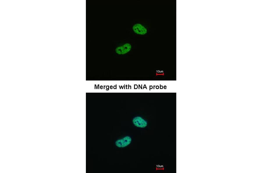 Immunofluorescence - WT1 antibody from Signalway Antibody (22694) - Antibodies.com