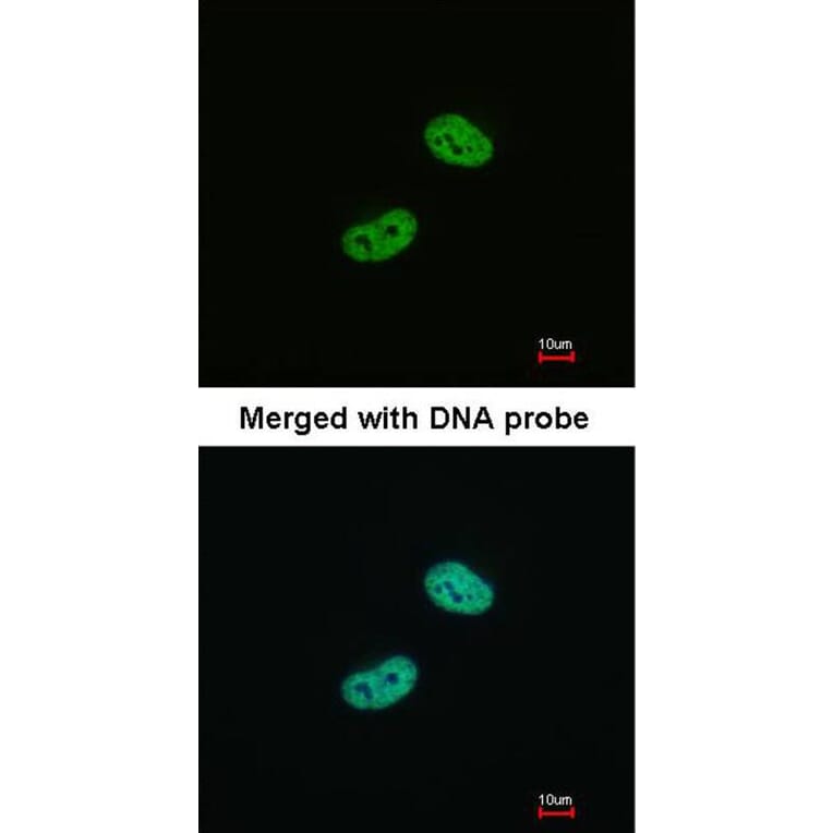 Immunofluorescence - WT1 antibody from Signalway Antibody (22694) - Antibodies.com