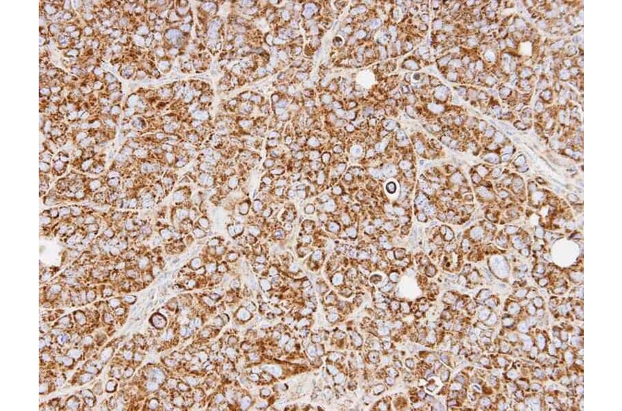 Immunohistochemistry - REA antibody from Signalway Antibody (22802) - Antibodies.com
