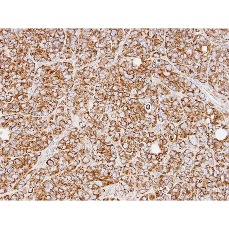 Immunohistochemistry - REA antibody from Signalway Antibody (22802) - Antibodies.com