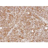 Immunohistochemistry - REA antibody from Signalway Antibody (22802) - Antibodies.com