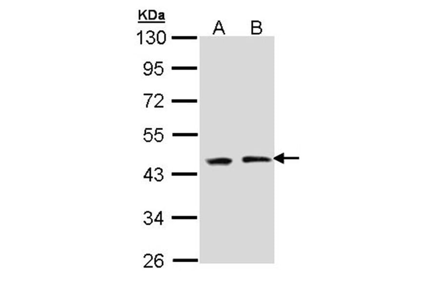 EED antibody from Signalway Antibody (22861) - Antibodies.com