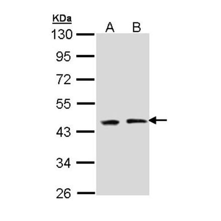 EED antibody from Signalway Antibody (22861) - Antibodies.com