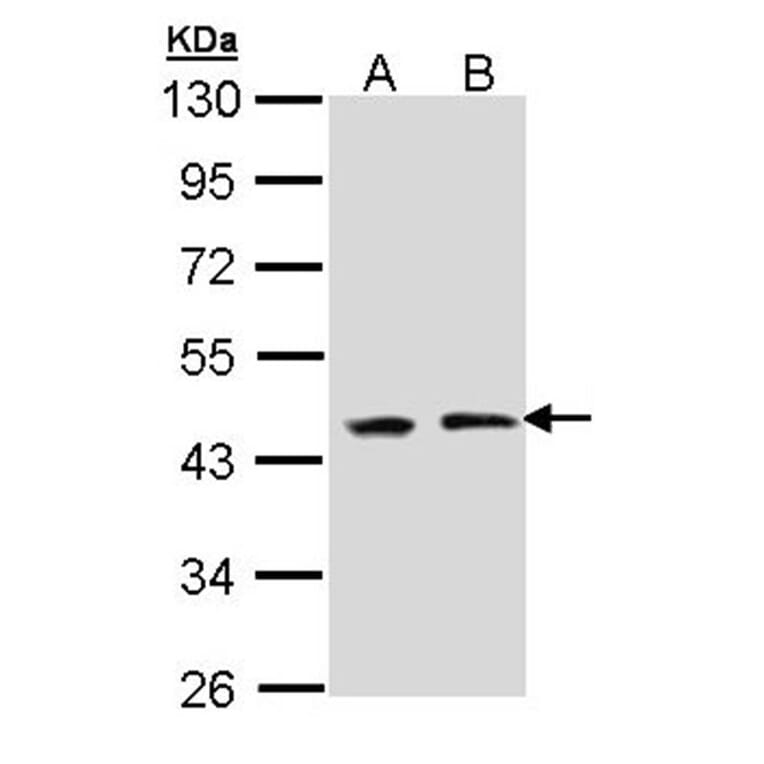 EED antibody from Signalway Antibody (22861) - Antibodies.com