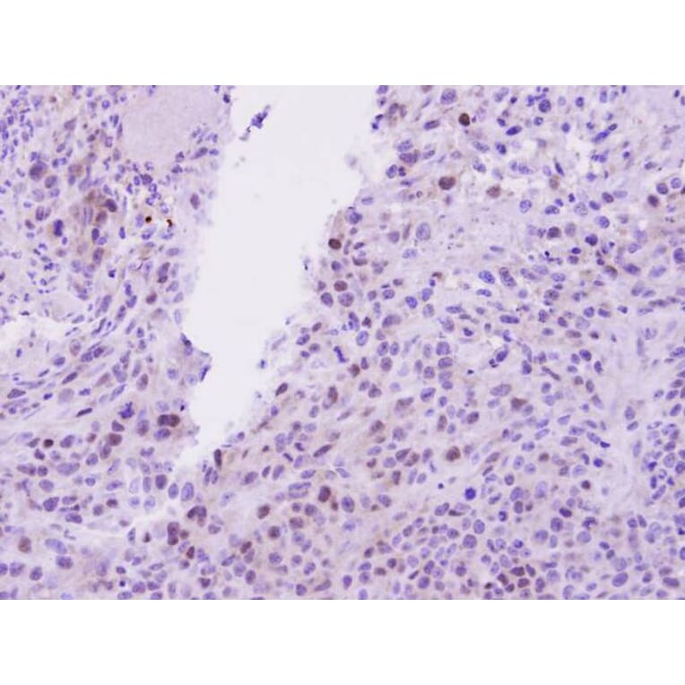 Immunohistochemistry - EED antibody from Signalway Antibody (22861) - Antibodies.com