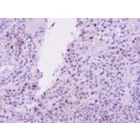 Immunohistochemistry - EED antibody from Signalway Antibody (22861) - Antibodies.com