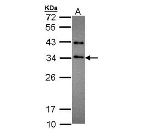 SET antibody from Signalway Antibody (23071) - Antibodies.com