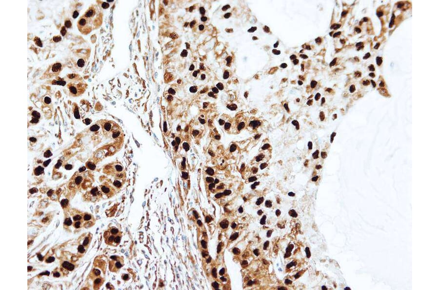 Immunohistochemistry - SET antibody from Signalway Antibody (23071) - Antibodies.com