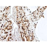 Immunohistochemistry - SET antibody from Signalway Antibody (23071) - Antibodies.com