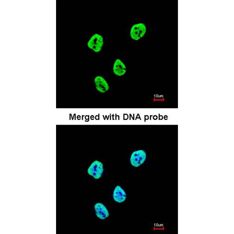 Immunofluorescence - SET antibody from Signalway Antibody (23071) - Antibodies.com