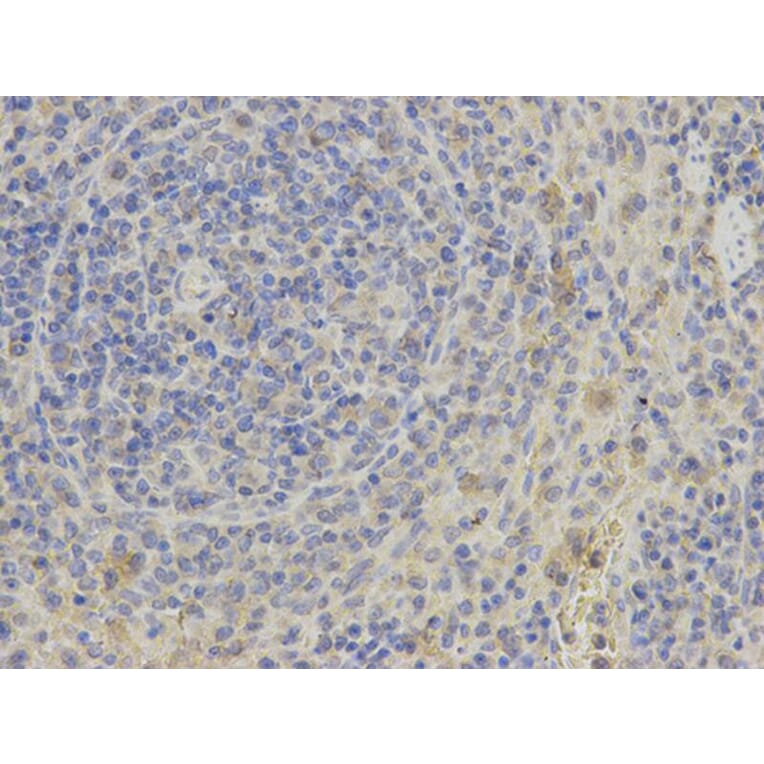 Immunohistochemistry - PHB Antibody from Signalway Antibody (32002) - Antibodies.com