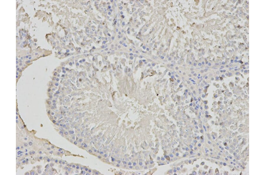 Immunohistochemistry - PHB Antibody from Signalway Antibody (32002) - Antibodies.com