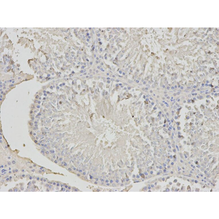 Immunohistochemistry - PHB Antibody from Signalway Antibody (32002) - Antibodies.com