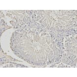Immunohistochemistry - PHB Antibody from Signalway Antibody (32002) - Antibodies.com
