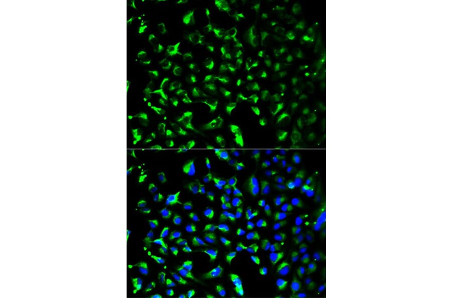 Immunofluorescence - PHB Antibody from Signalway Antibody (32002) - Antibodies.com