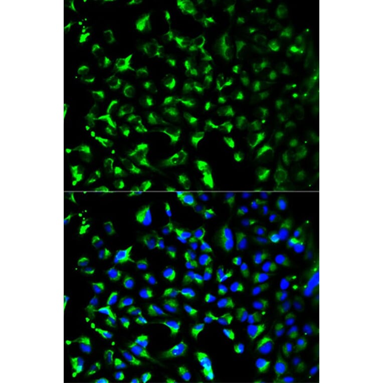 Immunofluorescence - PHB Antibody from Signalway Antibody (32002) - Antibodies.com