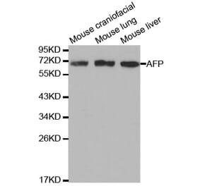 Western blot - AFP Antibody from Signalway Antibody (32006) - Antibodies.com