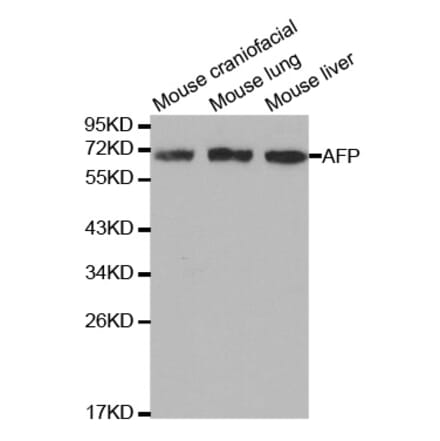 Western blot - AFP Antibody from Signalway Antibody (32006) - Antibodies.com