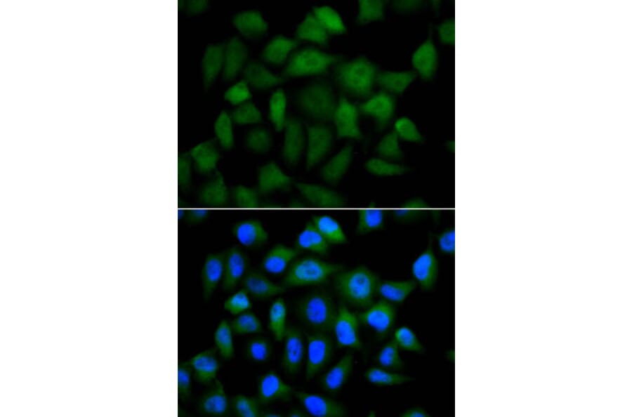 Immunofluorescence - AFP Antibody from Signalway Antibody (32006) - Antibodies.com