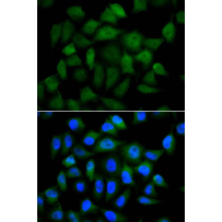 Immunofluorescence - AFP Antibody from Signalway Antibody (32006) - Antibodies.com