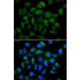 Immunofluorescence - AFP Antibody from Signalway Antibody (32006) - Antibodies.com