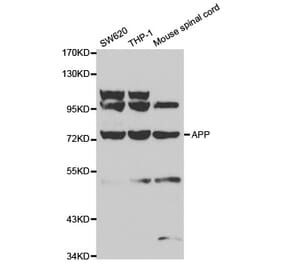 Western blot - APP Antibody from Signalway Antibody (32010) - Antibodies.com