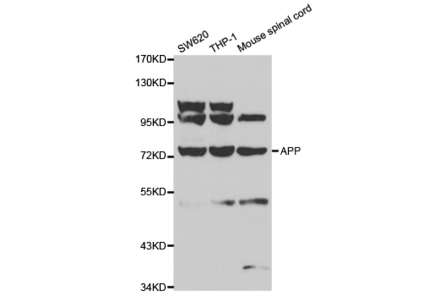 Western blot - APP Antibody from Signalway Antibody (32010) - Antibodies.com