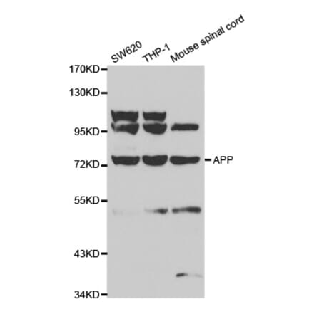 Western blot - APP Antibody from Signalway Antibody (32010) - Antibodies.com