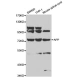 Western blot - APP Antibody from Signalway Antibody (32010) - Antibodies.com