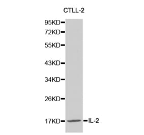 Western blot - IL2 Antibody from Signalway Antibody (32069) - Antibodies.com