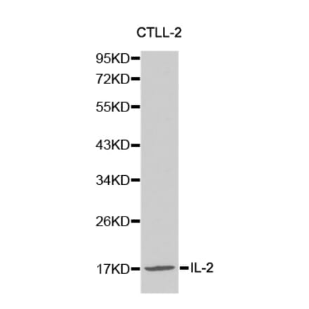 Western blot - IL2 Antibody from Signalway Antibody (32069) - Antibodies.com