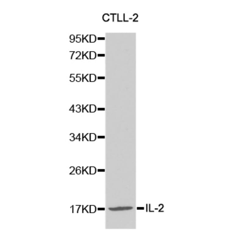 Western blot - IL2 Antibody from Signalway Antibody (32069) - Antibodies.com
