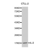 Western blot - IL2 Antibody from Signalway Antibody (32069) - Antibodies.com