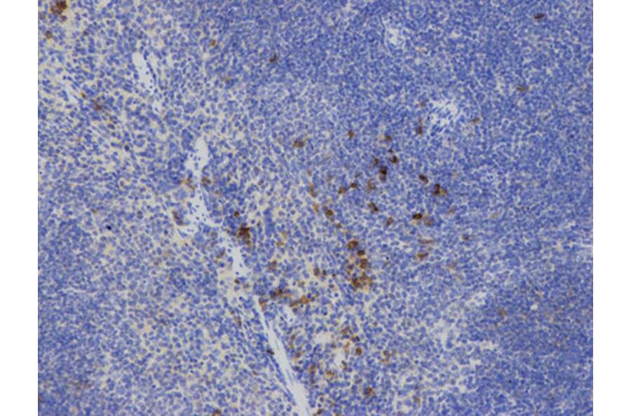 Immunohistochemistry - IL2 Antibody from Signalway Antibody (32069) - Antibodies.com