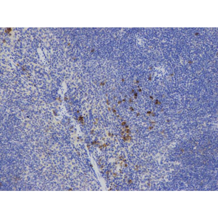 Immunohistochemistry - IL2 Antibody from Signalway Antibody (32069) - Antibodies.com
