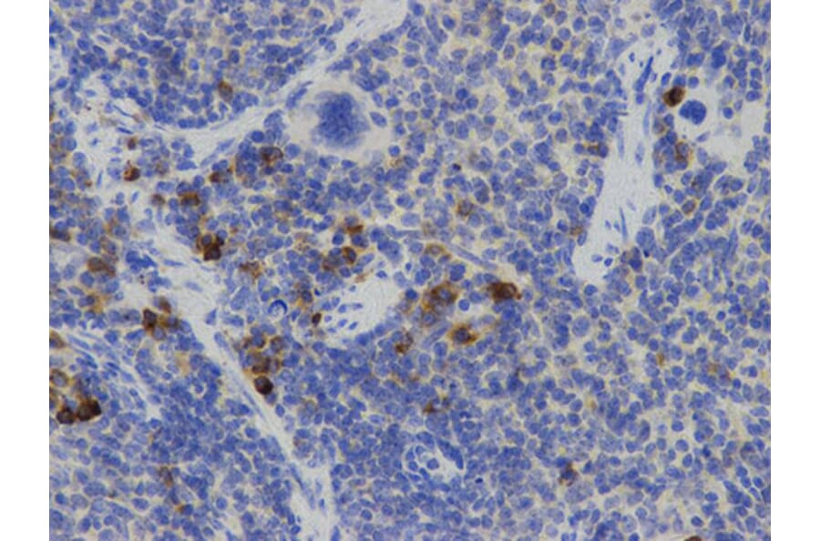 Immunohistochemistry - IL2 Antibody from Signalway Antibody (32069) - Antibodies.com