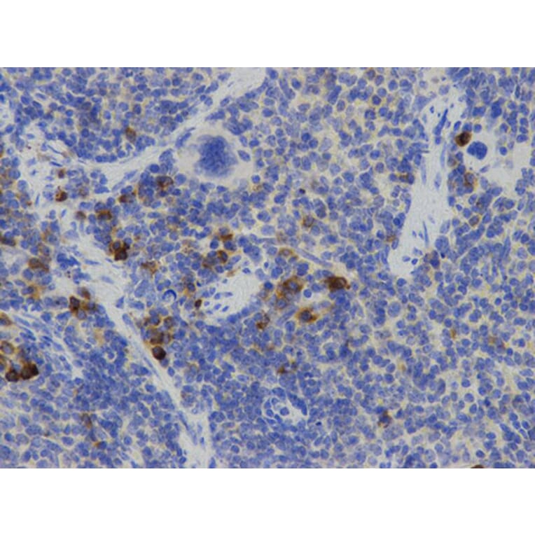 Immunohistochemistry - IL2 Antibody from Signalway Antibody (32069) - Antibodies.com