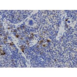 Immunohistochemistry - IL2 Antibody from Signalway Antibody (32069) - Antibodies.com