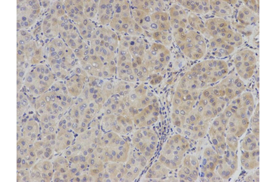 Immunohistochemistry - IL2 Antibody from Signalway Antibody (32069) - Antibodies.com