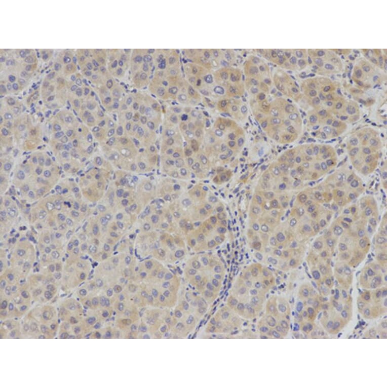 Immunohistochemistry - IL2 Antibody from Signalway Antibody (32069) - Antibodies.com