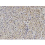 Immunohistochemistry - IL2 Antibody from Signalway Antibody (32069) - Antibodies.com