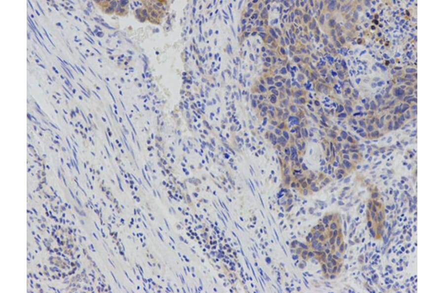 Immunohistochemistry - IL2 Antibody from Signalway Antibody (32069) - Antibodies.com