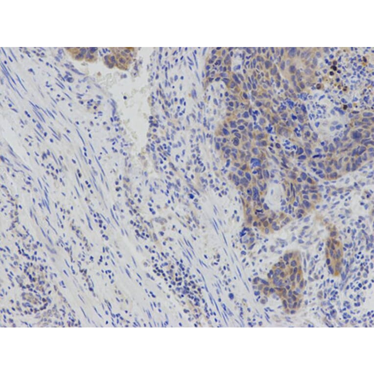 Immunohistochemistry - IL2 Antibody from Signalway Antibody (32069) - Antibodies.com