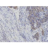 Immunohistochemistry - IL2 Antibody from Signalway Antibody (32069) - Antibodies.com