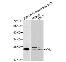 Western blot - VHL Antibody from Signalway Antibody (32075) - Antibodies.com