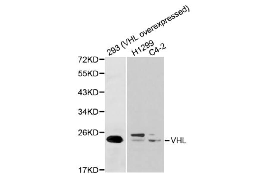 Western blot - VHL Antibody from Signalway Antibody (32075) - Antibodies.com