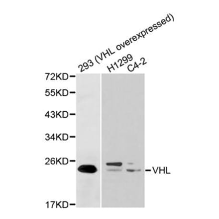 Western blot - VHL Antibody from Signalway Antibody (32075) - Antibodies.com